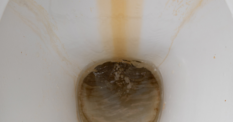 Rust In The Toilet Bowl? (Here’s How To Remove It!)